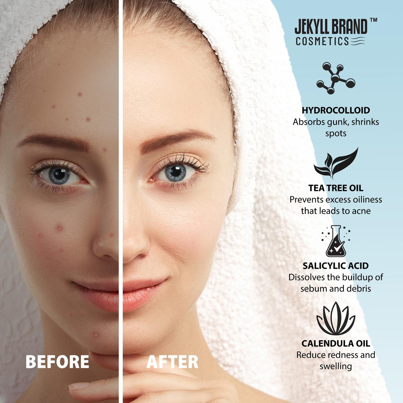 Nose Pore Patch for Pimples, Blemishes & Acne – Hydrocolloid Spot Treatment for Clear, Smooth Skin